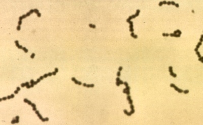 Image of organism in genus Streptococcus pasteurianus