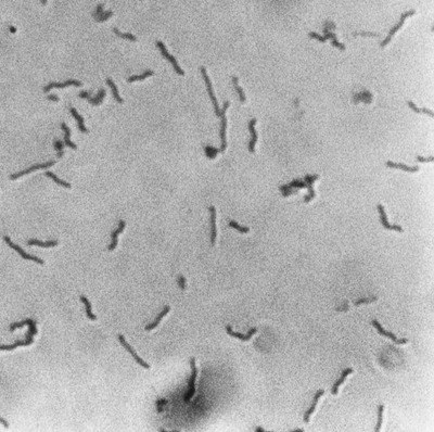 Image of organism in genus Succinatimonas sp. UBA2849 & sp. CAG:777