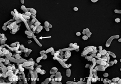 Image of organism in genus unclassified Sutterella