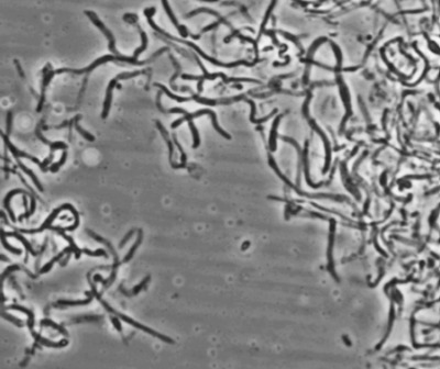 Image of organism in genus Turicibacter sanguinis 1
