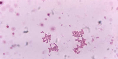 Image of organism in genus unclassified Veillonella